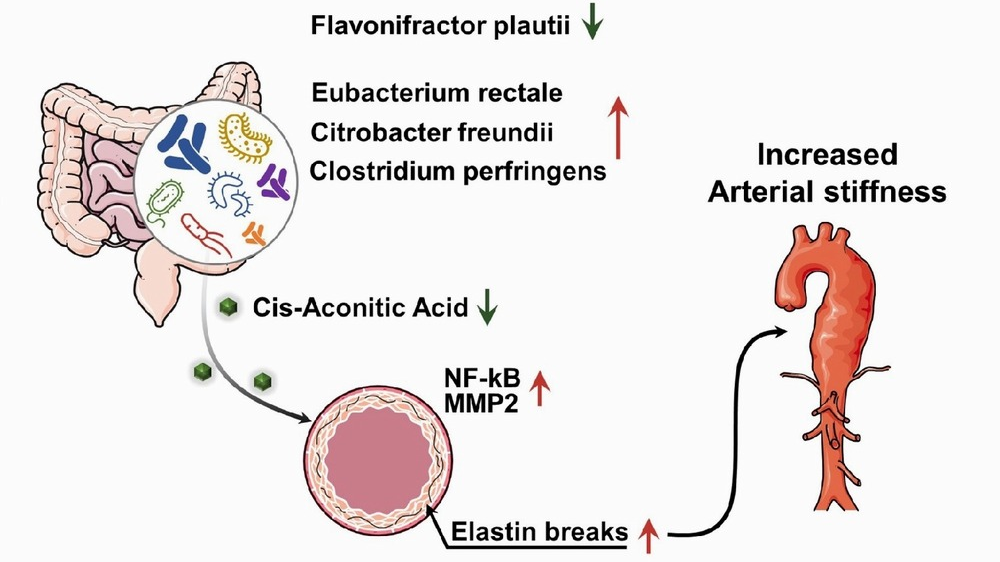 نقش محافظتی باکتری Flavonifractor plautii در برابر افزایش سفتی شریانی 
